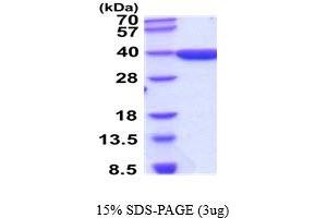 SDS-PAGE (SDS) image for Aldo-Keto Reductase Family 1, Member D1 (AKR1D1) (AA 1-326) protein (ABIN5854502)