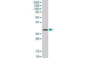 Western Blotting (WB) image for anti-Sine Oculis-Related Homeobox 3 (SIX3) (AA 273-332) antibody (ABIN520208)