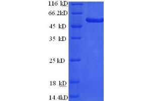 SDS-PAGE (SDS) image for PR Domain Containing 16 (PRDM16) (AA 19-471) protein (His tag) (ABIN5714164) (PRDM16 Protein (AA 19-471) (His tag))
