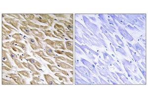 Immunohistochemistry analysis of paraffin-embedded human heart tissue using MRPL39 antibody. (MRPL39 antibody  (C-Term))