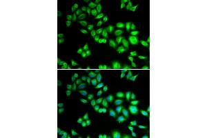 Immunofluorescence analysis of HeLa cells using CUL1 antibody. (Cullin 1 antibody)