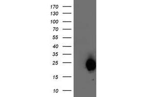 HEK293T cells were transfected with the pCMV6-ENTRY control (Left lane) or pCMV6-ENTRY ARL11 (Right lane) cDNA for 48 hrs and lysed. (ARL11 antibody)