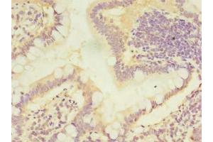 Immunohistochemistry of paraffin-embedded human small intestine tissue using ABIN7146755 at dilution of 1:100 (CMBL antibody  (AA 2-245))
