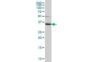 LZTFL1 monoclonal antibody (M01), clone 7F6 Western Blot analysis of LZTFL1 expression in HeLa . (LZTFL1 antibody  (AA 200-299))