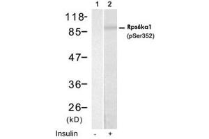 Western blot analysis of extract from HUVEC cells using Rps6ka1 (phospho S352) polyclonal antibody (Cat # PAB12168, Lane 1 and 2). (RPS6KA1 antibody  (pSer352))
