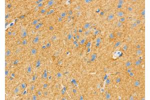ABIN6262047 and ABIN6279612 at 1/100 staining Rat brain tissue by IHC-P. (GPM6B antibody  (N-Term))