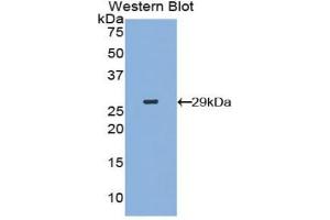Western blot analysis of the recombinant protein. (MAP4K5 antibody  (AA 9-231))