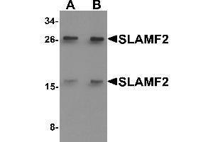 Western blot analysis of SLAMF2 in rat lung tissue lysate with SLAMF2 antibody at (A) 1 and (B) 2 µg/mL. (CD48 antibody  (Middle Region))