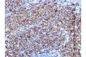Immunohistochemistry of paraffin-embedded rat spleen using CD79B Rabbit mAb (ABIN1682474, ABIN3018855, ABIN3018856 and ABIN7101674) at dilution of 1:100 (40x lens). (CD79b antibody)