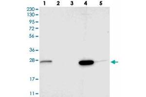 Western blot analysis of Lane 1: RT-4, Lane 2: U-251 MG, Lane 3: Human Plasma, Lane 4: Liver, Lane 5: Tonsil with SIGMAR1 polyclonal antibody . (SIGMAR1 antibody)