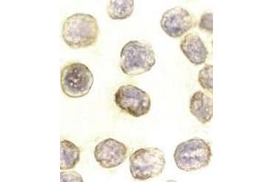 Immunocytochemical staining of DAXX in HeLa cells with DAXX antibody at 10μg/ml. (DAXX antibody)