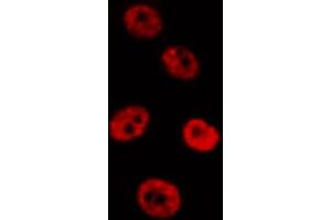 ABIN6267658 staining HepG2 by IF/ICC. (SMAD2 antibody  (pSer467))