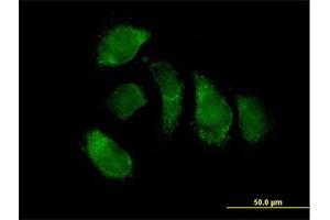 Immunofluorescence of purified MaxPab antibody to EHHADH on HeLa cell.