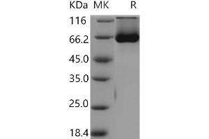 Western Blotting (WB) image for Protein tyrosine Phosphatase, Non-Receptor Type 11 (PTPN11) (Active) protein (His tag) (ABIN7197591)