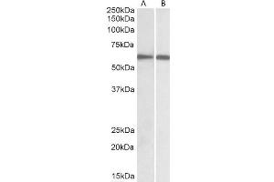 ABIN184812 staining (1µg/ml) Human Spleen (A) and Peripheral Blood Lymphocytes (B) lysates (RIPA buffer, 30µg total protein per lane).