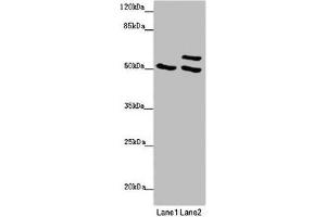 Western blot All lanes: TUBB4A antibody at 2 μg/mL Lane 1: 293T whole cell lysate Lane 2: Hela whole cell lysate Secondary Goat polyclonal to rabbit IgG at 1/10000 dilution Predicted band size: 50 kDa Observed band size: 50, 58 kDa (TUBB4 antibody  (AA 1-444))
