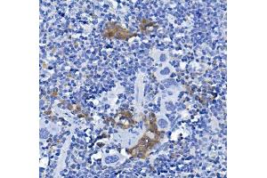 IHC analysis of CD72 using anti-CD72 antibody (ABIN7602483). (CD72 antibody  (AA 8-346))
