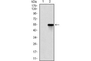 Western Blotting (WB) image for anti-rho-Associated, Coiled-Coil Containing Protein Kinase 1 (ROCK1) antibody (ABIN1846125) (ROCK1 antibody)