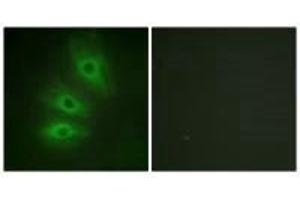 Immunofluorescence analysis of HeLa cells, using ADCY5/6 antibody. (ADCY6 antibody)