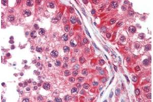 Human Testis (formalin-fixed, paraffin-embedded) stained with DPYSL2 antibody ABIN462302 followed by biotinylated anti-mouse IgG secondary antibody ABIN481714, alkaline phosphatase-streptavidin and chromogen. (DPYSL2 antibody  (AA 463-492))
