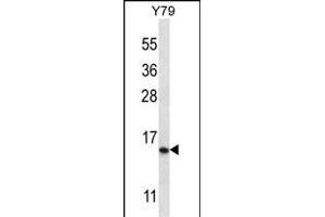 NR2C2 Antibody (N-term) 12673a western blot analysis in Y79 cell line lysates (35 μg/lane).