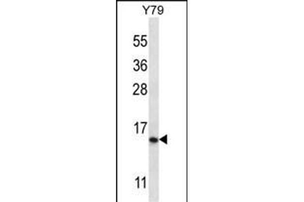 NR2C2AP Antikörper  (N-Term)
