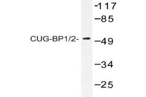 Western blot (WB) analysis of CUG-BP1/2 antibody in extracts from HeLa cells. (CELF1 antibody)