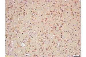 Formalin-fixed and paraffin embedded rat brain labeled with Rabbit Anti-CYPA Polyclonal Antibody, Unconjugated (ABIN759716) at 1:200 followed by conjugation to the secondary antibody and DAB staining (PPIA antibody  (AA 101-165))