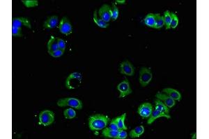 Immunofluorescent analysis of MCF-7 cells using ABIN7143807 at dilution of 1:100 and Alexa Fluor 488-congugated AffiniPure Goat Anti-Rabbit IgG(H+L) (ADRA2A antibody  (AA 218-374))