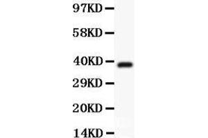 Anti-Hamartin Picoband antibody,  All lanes: Anti Hamartin  at 0. (TSC1 antibody  (AA 686-884))