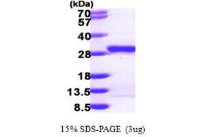SDS-PAGE (SDS) image for Mesoderm Development Candidate 2 (MESDC2) (AA 34-234) protein (His tag) (ABIN667879)