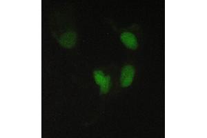 IF analysis of PPCS using anti-PPCS antibody (ABIN6719631).