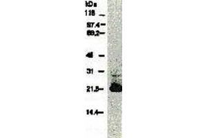 Western Blotting (WB) image for anti-Hepatitis C Virus Core Protein (HCV C) (AA 13-124), (AA 369-704) antibody (FITC) (ABIN2451998)