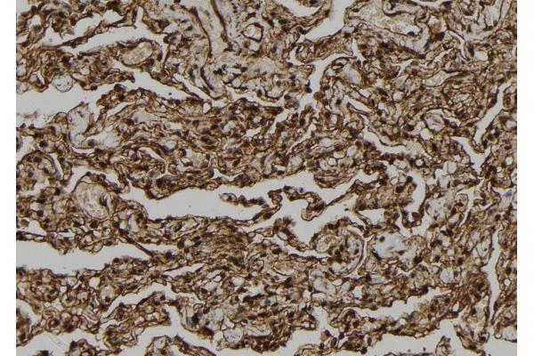 CARD18 antibody  (C-Term)