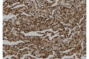 ABIN6278874 at 1/100 staining Human lung tissue by IHC-P.