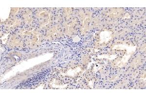 Detection of PDGFB in Porcine Kidney Tissue using Polyclonal Antibody to Platelet Derived Growth Factor Subunit B (PDGFB) (PDGFB antibody  (AA 84-199))