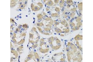Immunohistochemistry of paraffin-embedded Human stomach using PSPH Polyclonal Antibody at dilution of 1:100 (40x lens). (PSPH antibody)