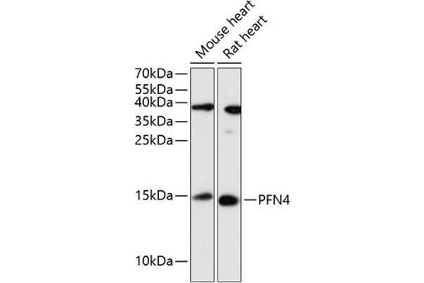 Profilin 4 antibody  (AA 1-129)