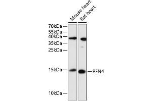 Western blot analysis of extracts of various cell lines, using PFN4 antibody (ABIN6129663, ABIN6145495, ABIN6145496 and ABIN6217780) at 1:3000 dilution. (Profilin 4 antibody  (AA 1-129))