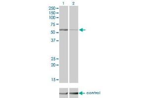 Western blot analysis of STK38 over-expressed 293 cell line, cotransfected with STK38 Validated Chimera RNAi (Lane 2) or non-transfected control (Lane 1). (STK38 antibody  (AA 365-465))