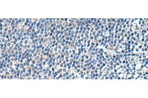 Immunohistochemistry of paraffin-embedded Human tonsil tissue using KIF2A Polyclonal Antibody at dilution of 1:65(x200) (KIF2A antibody)
