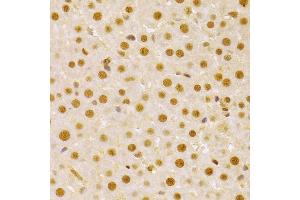 Immunohistochemistry (IHC) image for anti-Cell Division Cycle 25 Homolog A (S. Pombe) (CDC25A) (AA 235-484) antibody (ABIN3021626)