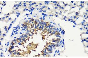 Immunohistochemistry of paraffin-embedded Mouse lung using FKBP1A Polyclonal Antibody at dilution of 1:200 (40x lens).