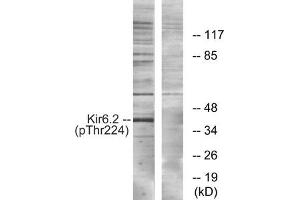 Western blot analysis of extracts from HeLa cells, using Kir6.