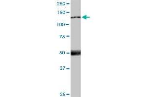 MTUS1 monoclonal antibody (M01), clone 1C7. (MTUS1 antibody  (AA 1-240))