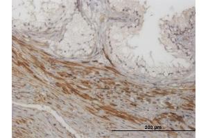 Immunoperoxidase of monoclonal antibody to NKIRAS1 on formalin-fixed paraffin-embedded human prostate. (NKIRAS1 antibody  (AA 1-100))