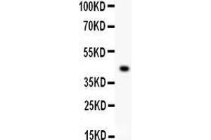 Anti- EDA antibody, Western blotting All lanes: Anti EDA  at 0. (Ectodysplasin A antibody  (AA 30-391))