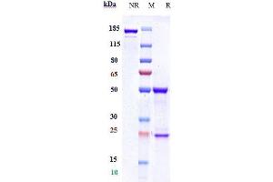 Anti-HTRA1 Reference Antibody (FHTR2163) on SDS-PAGE under reducing (R) condition.