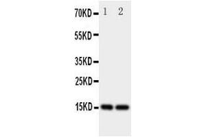 Anti-Fatty Acid Binding Protein 5 antibody, Western blottingAll lanes: Anti Fatty Acid Binding Protein 5  at 0. (FABP5 antibody  (N-Term))