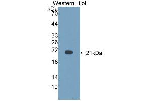 Detection of Recombinant CD164, Rat using Polyclonal Antibody to Cluster Of Differentiation 164 (CD164) (CD164 antibody  (AA 24-160))
